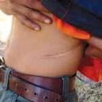 கிட்னி மோசடி புரிந்த தரகர் கைது